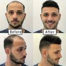 Alimice Men Hair Tropper Hair Pieces Short Wig Black Short Wig Breathable Invisible Daily Straight Bangs Clip On Hair Extensions