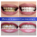 BREYLEE Teeth Whitening Powder Toothpaste Remove Plaque Stains Bleaching Dental Tools Oral Hygiene White Toothbrush Cleaning 30g