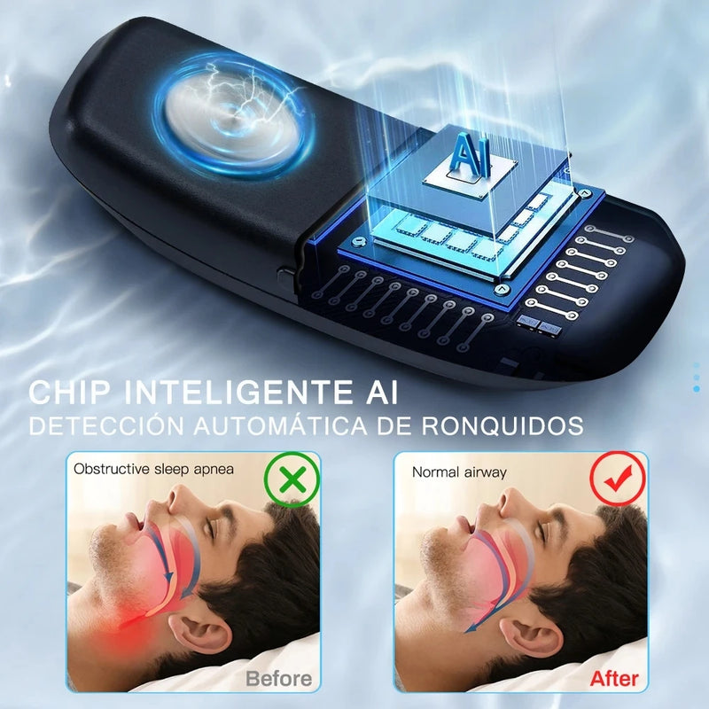 Anti-snoring Device Pure Sleeping Helper Electric Smart Snore Corrector Comfortable Devices For Snoring