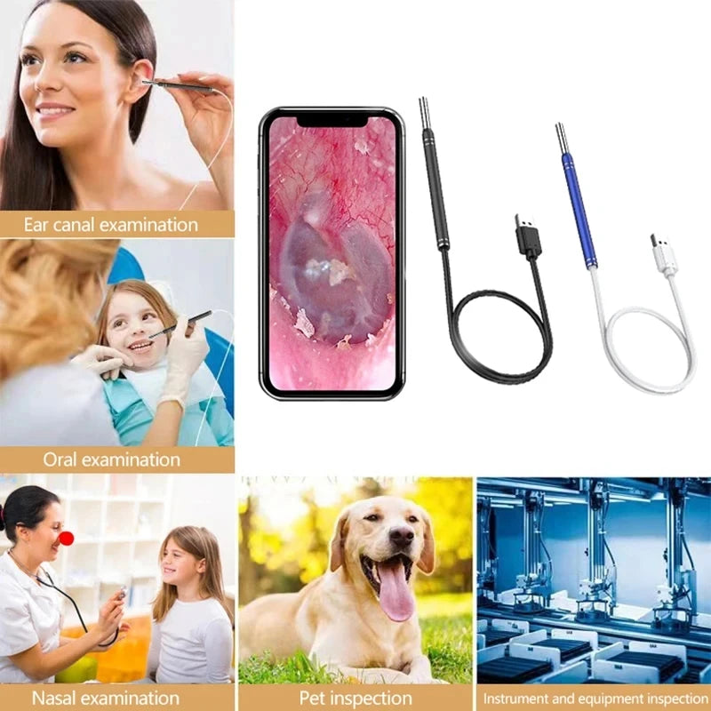 5.5MM HD Visual Ear Endoscope 3 in 1 USB Otoscope Ear Wax Cleaning Inspection Camera Tools for Android Phone PC