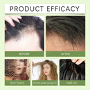 Shampoo Soap Deep Cleansing Scalp Massage Hair Solid Shampoo Soap Gently Cleansing And Balancing Ph Value Care Hair