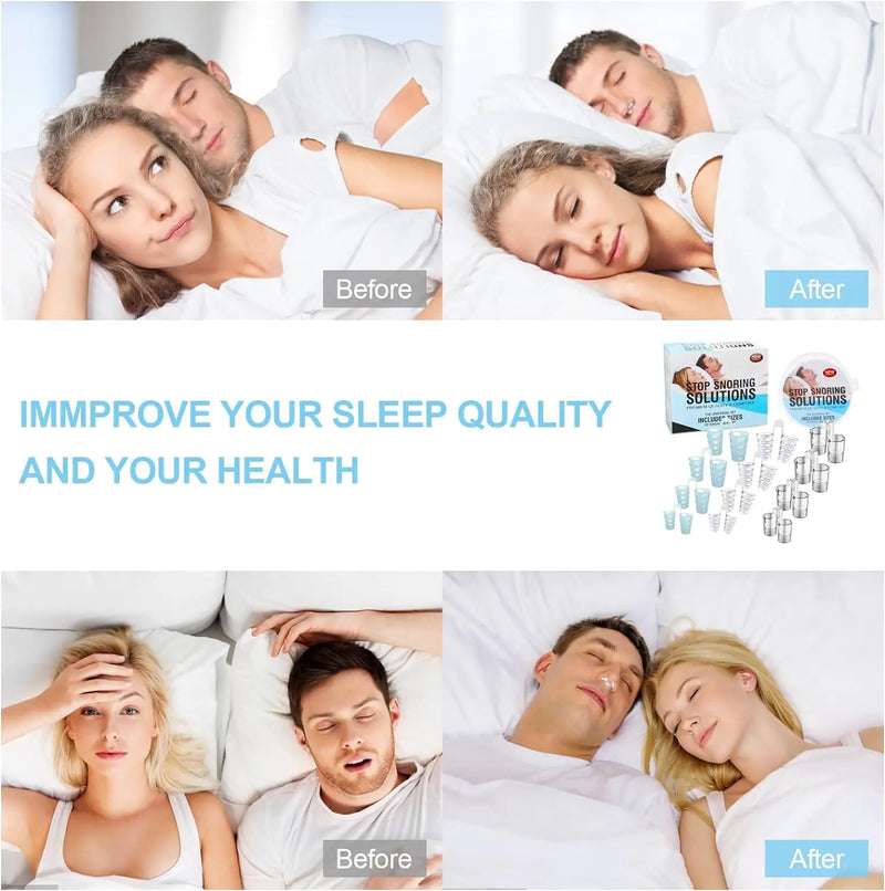 4PCS Anti Snoring Nasal Dilator For Easy Breathing Preventing Snoring Making It Better For Respiratory Health Care