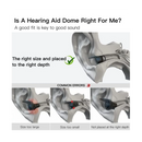 Hearing Aid Domes for Phonak Marvel & Paradise RIC BTE Models SDS 4.0 Large Open Dome 10mm 20 Pcs Pack,Large