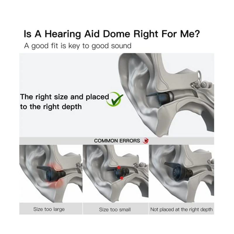 Hearing Aid Domes for Phonak Marvel & Paradise RIC BTE Models SDS 4.0 Large Open Dome 10mm 20 Pcs Pack,Large