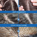 PURC Hair Scalp Treatment Hair Oil Dandruff Itching Anti Loss Oil Control Smoothing Essence Spray Hair Care Beauty Health 60ML