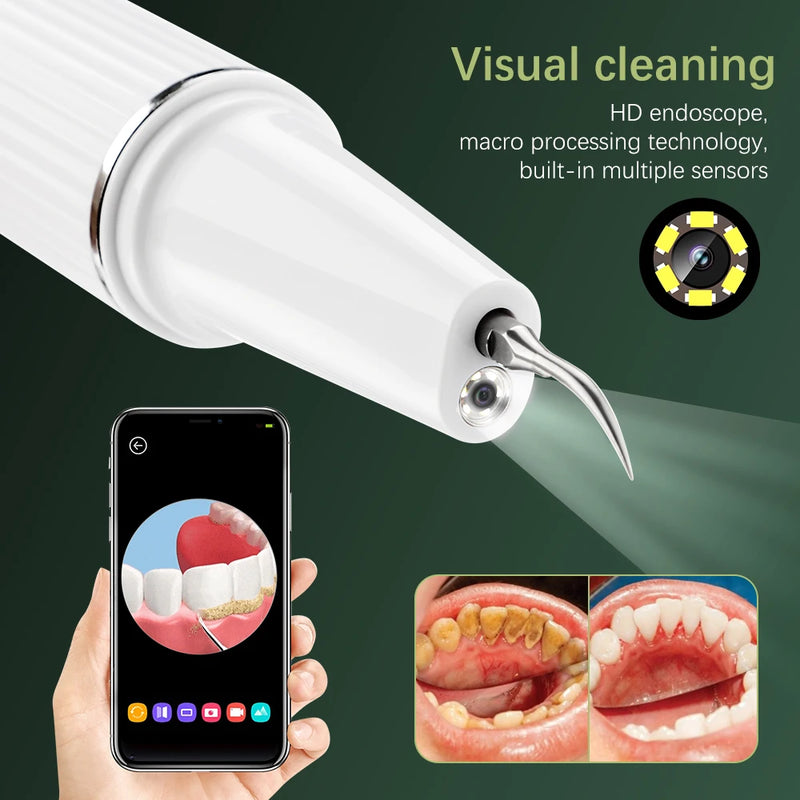 Visual Ultrasonic Dental Scaler Teeth Whitening Cleaner Dental Stone Calculus Plaque Stains Removal Tartar Scraper Oral Care