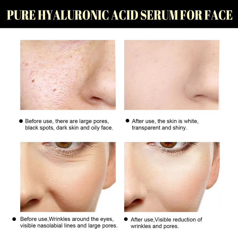 3PCS Soluble Protein Elevation Line Reduce Fine Lines On The Face, Improve Skin Elasticity, Moisturize And Nourish The Skin