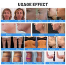 The Helios Contour | 360-degree Ultrasonic Body Sculpting & RF Skin Rejuvenation Platform