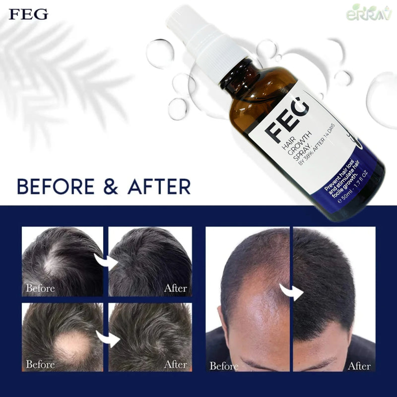 FEG Hair Growth Spray Advanced Formula Rapid and Effective Scalp Care Hair Strengthening Revitalizing Salon-QualityBattle