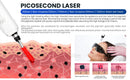 The Titan Quartet | Soprano Titanium 4-Wavelength Diode Laser Platform