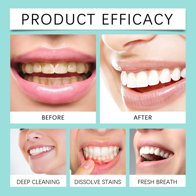 Brightening Whitening Yellow Tooth Toothpaste Foam Cleaning Effective Removal of Tooth Stains, Oral Cleaning Product