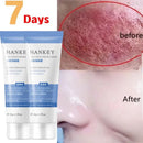 Facial Redness Repair Cream Sensitive Skin Dryness Moisturizer Hydrating Sooth Serum Lotion  Removal Rosacea Skin Care Ointments