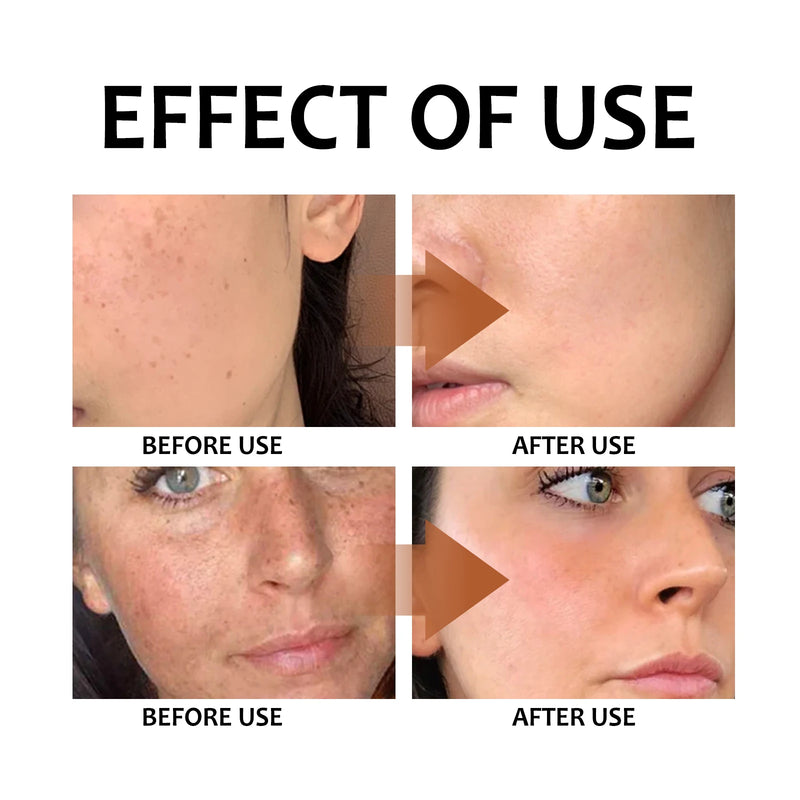 Lemon Turmeric Handmade Soap Lemon Kojic Acid Soap Bath and Facial Soap Strongly Moisturizes and Cleanses The Skin