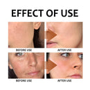 Lemon Turmeric Handmade Soap Lemon Kojic Acid Soap Bath and Facial Soap Strongly Moisturizes and Cleanses The Skin