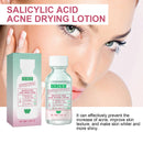 OUHOE Salicylic Acid Acne Drying Lotion Salicylic Acid Deeply Removes Acne Repair Facial Moisturizing Hydrating Serum