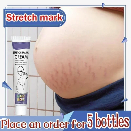 Stretch Marks Treatment Repair Essential Oil Skin Care Cream For Maternity Remover Anti-Wrinkle Slackline For Pregnant Body Oils