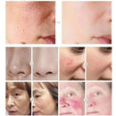 Facial Redness Repair Cream Sensitive Skin Dryness Moisturizer Hydrating Sooth Serum Lotion  Removal Rosacea Skin Care Ointments
