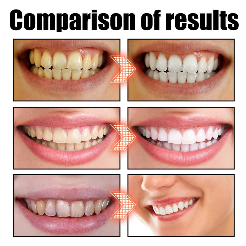 Coconut Mint Pulling Oil Mouthwash Alcohol-free Teeth Whitening Fresh Oral Breath Tongue Scraper Set Mouth Heal