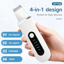 Ultrasonic Skin Cleaning Tool - USB Rechargeable, Vibrating Facial Blackhead Remover, Spatula Exfoliating Beauty Tool, Affordable Skincare Equipment, 4 Modes, The Perfect Tool For Removing Blackheads