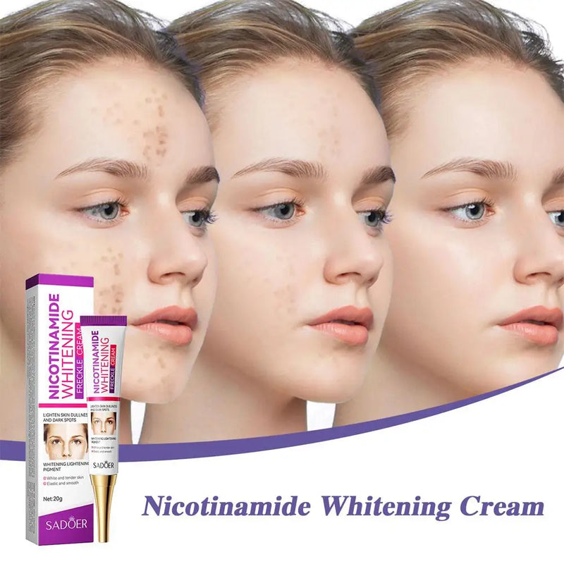 1/3pcs Nicotinamide Whitening Freckles Cream Remove Melasma Dark Spot Acne Marks Brightening Skin Tone Face Skin Care