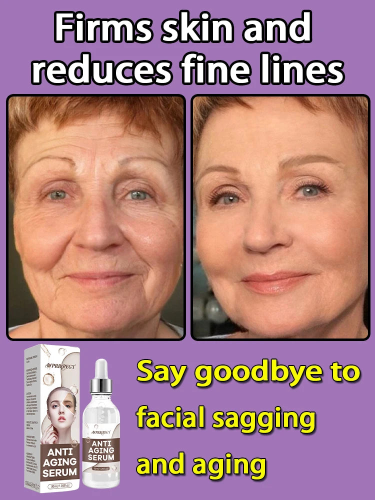 Make wrinkles disappear in one week