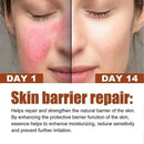 Facial Redness Repair Cream Sensitive Skin Dryness Moisturizer Hydrating Sooth Serum Lotion  Removal Rosacea Skin Care Ointments