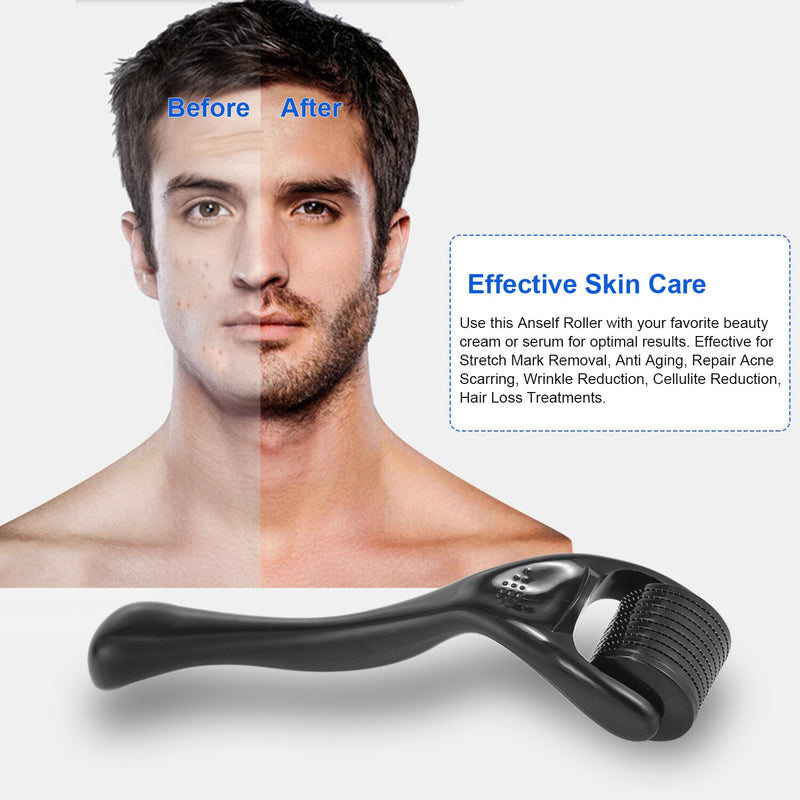 Micro Needle 540 Derma Roller 0,25 mm Titan-Bartroller für das Nachwachsen der Haare Bartwachstum Anti-Haarausfall-Hautpflegebehandlung