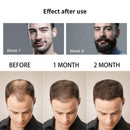 4 Pcs/Set Beard Growth Kit Men&