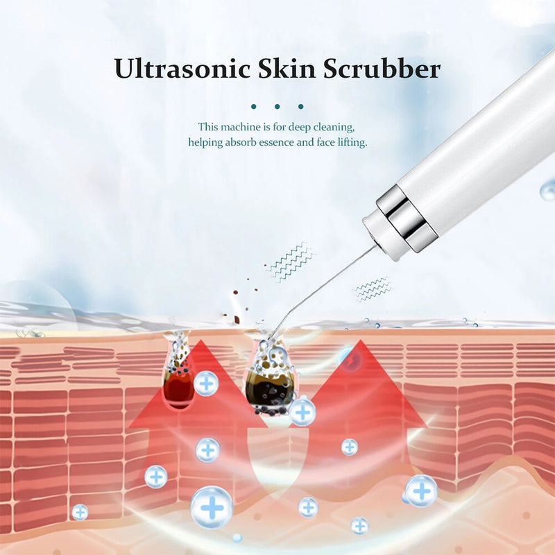 Ultraschall-Hautwäscher, elektrische Gesichtsreinigung, Porentiefenreiniger, Akne, Mitesser-Entferner, Peeling-Schaufelgerät, Schönheitsmaschine