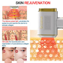 Osenyuan T023C Permanent Hair Removal Safe Effective Painless Laser Epilator Body Bikini Arm Underarm Face Facial Beauty Salon