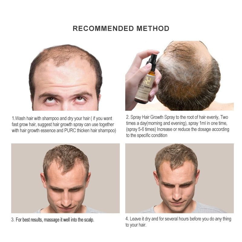 PURC 2pcs Fast Hair Growth Products Sets Nachwachsen Spray Haarpflege Kopfhautbehandlung Ingwerextrakt Verhindern Haarausfall Für Männer Frauen
