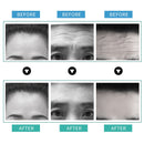 Ilisya Forehead Furrow Patch Anti-wrinkle Line Removal Stickers Frown Lines Hydrogels Anti-aging Moisturizng Patch Skin Care