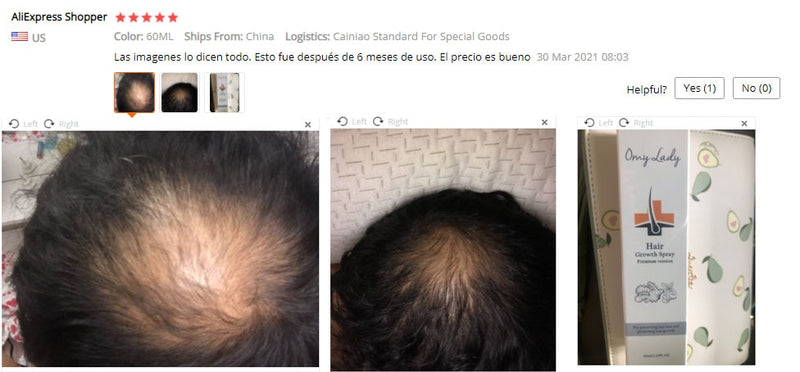 OMY LADY Haarwachstumsspray Anti-Haarausfall Essenziell Schnelles Nachwachsen Verhindert Haarschäden Ausdünnung Reparaturpflege Kopfhautbehandlung 60ml