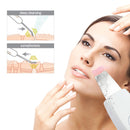 Limpiador facial ultrasónico Beauty Star, depurador de piel, masajeador con vibración por ultrasonido, exfoliación por ultrasonido, depurador de elevación de tono limpio
