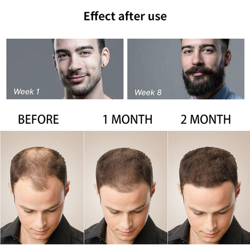 4 teile/satz Bartwachstumsset Männer Haarwachstumsverstärker Set Bartwachstum Ätherisches Öl Gesichtsbartpflegeset Bestes Geschenk für Männer
