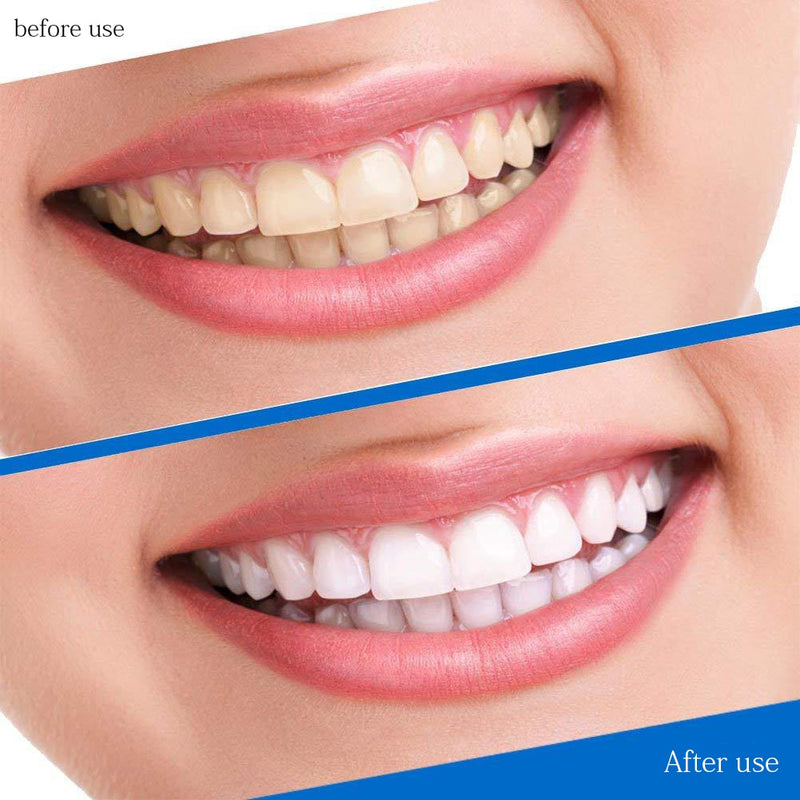 MJ 5D Gel Teeth Whitening Strips Oral Hygiene Care Double Elastic Tooth Bleaching Strips False Teeth Veneers Dental Whiten Tools