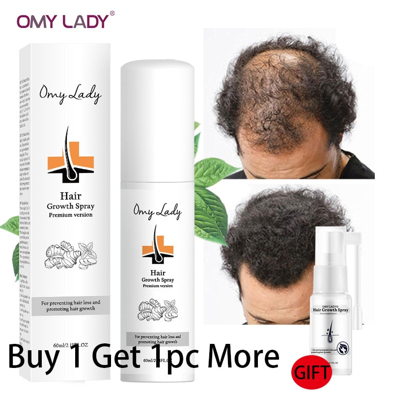 Spray para el crecimiento del cabello OMY LADY, antipérdida de cabello, esencial para el crecimiento rápido, previene el cabello dañado, adelgazamiento, reparación, tratamiento del cuero cabelludo, 60ml