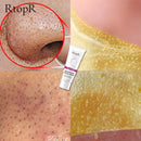 RtopR New Gold Remove Blackhead Gel Facial Pore Peeling Acne Treatment Nose Deep Cleansing Face Whitening Hydrating  Golden mud