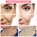 Electroporation LED Photon Facial RF Radio Frequency Skin Rejuvenation EMS Mesotherapy for Tighten Face Lift Beauty Treatment